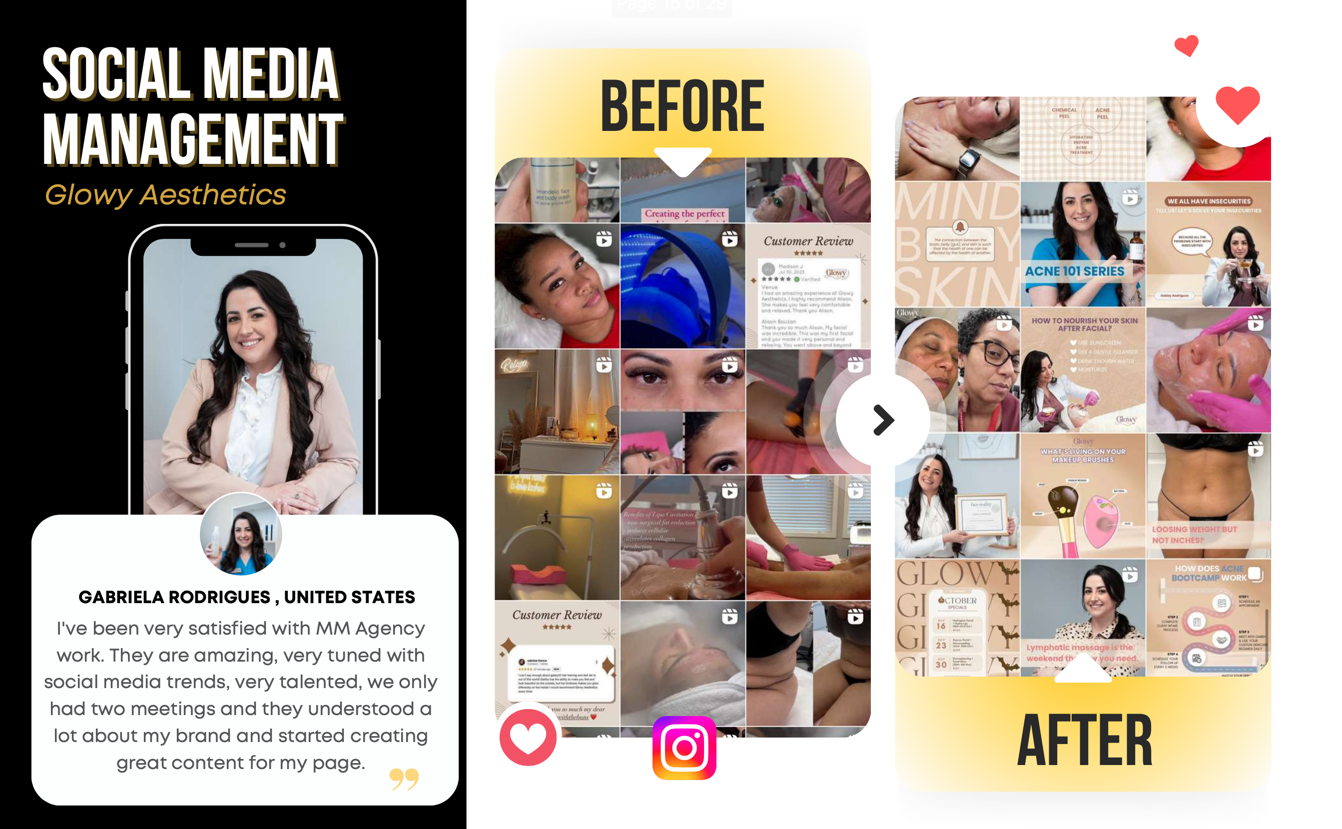 Glowy Aesthetics before and after social media transformation